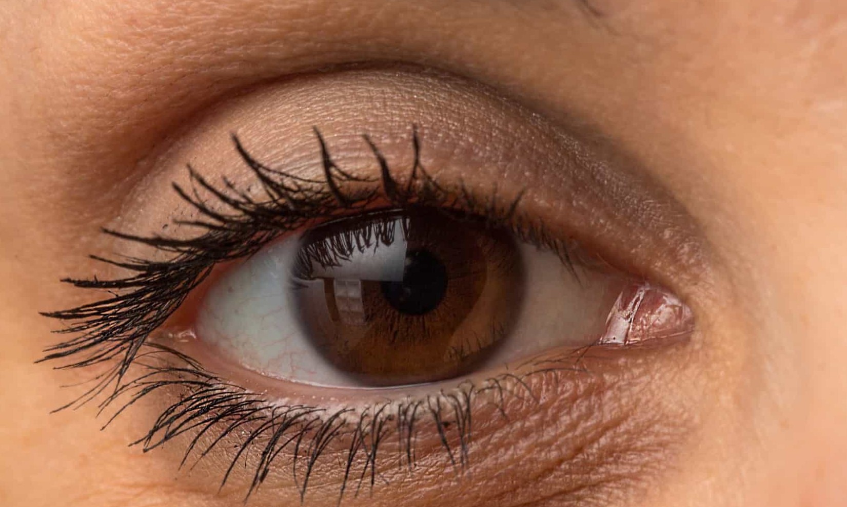 É possível se livrar das olheiras com uma maneira simples e natural