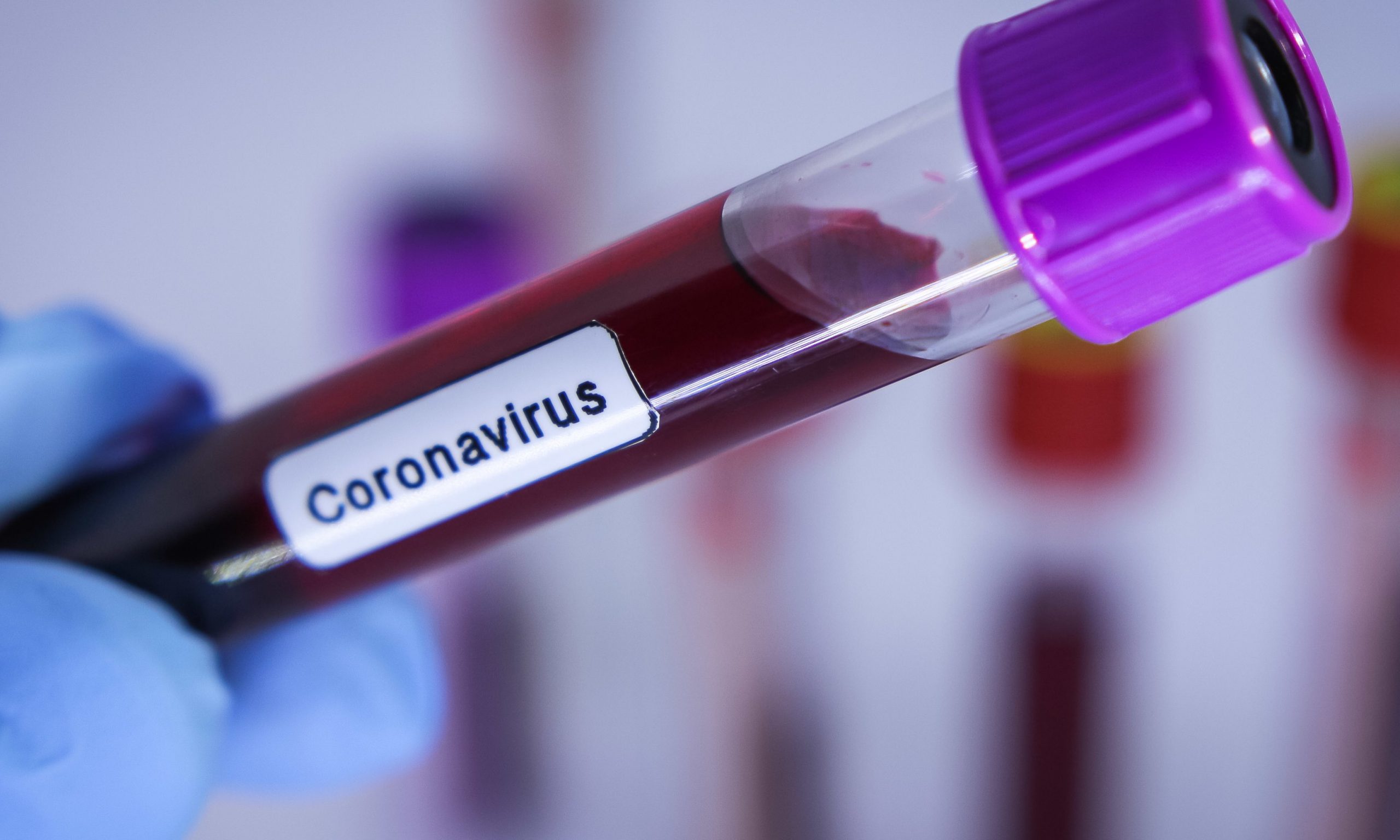 Você pode ser infectado com Covid-19 duas vezes? A resposta não é simples