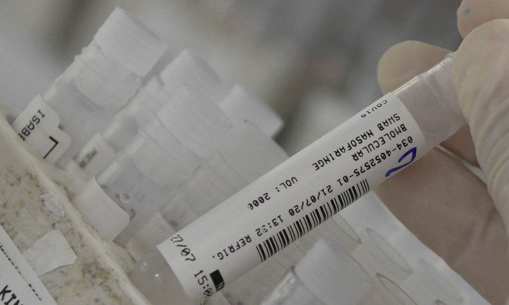 SP registra um leve aumento na média móvel de mortes por covid-19