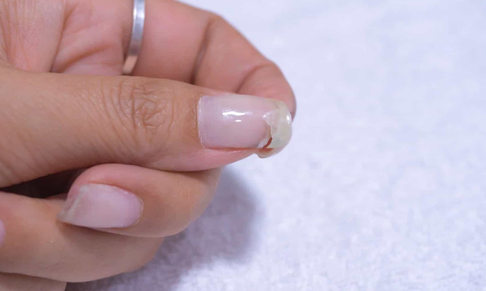 Resolva o problema de unhas fracas com uma simples misturinha caseira