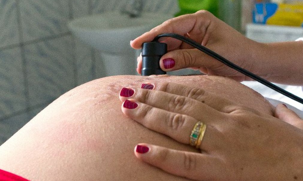 Campanha quer evitar cesarianas desnecessárias antes do Natal