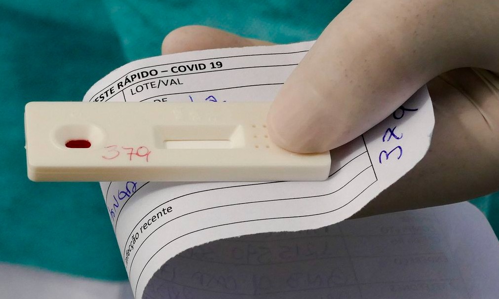 São Paulo confirma 1º caso de reinfecção por covid-19 no estado