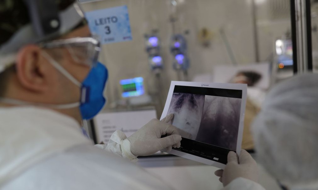 Casos de síndrome respiratória aguda grave caem