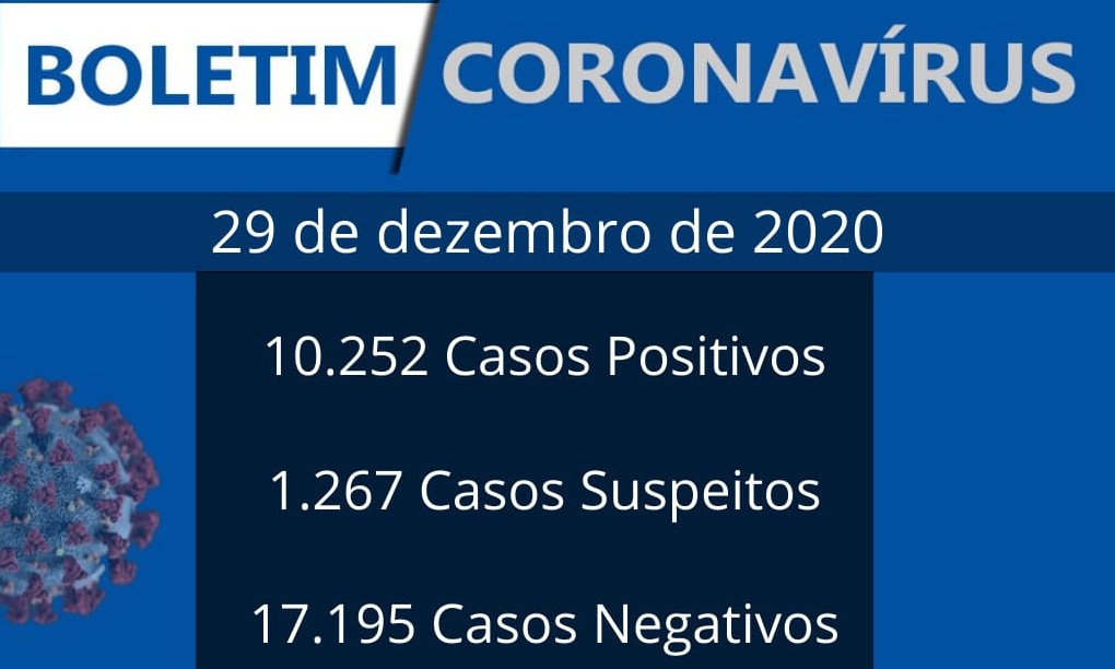 Franca registra 2 óbitos e 128 novos casos de covid-19 nesta terça-feira
