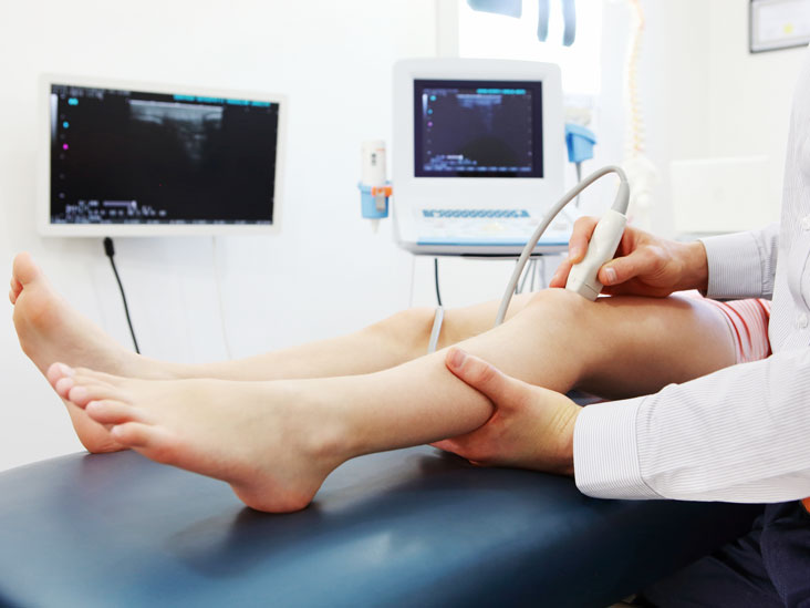 ultrassom doppler venoso